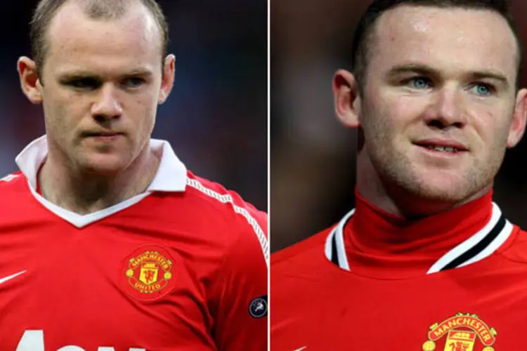 O jogador de 25 anos Wayne Rooney, do Manchester United, antes e depois de fazer transplante capilar (Getty Images)