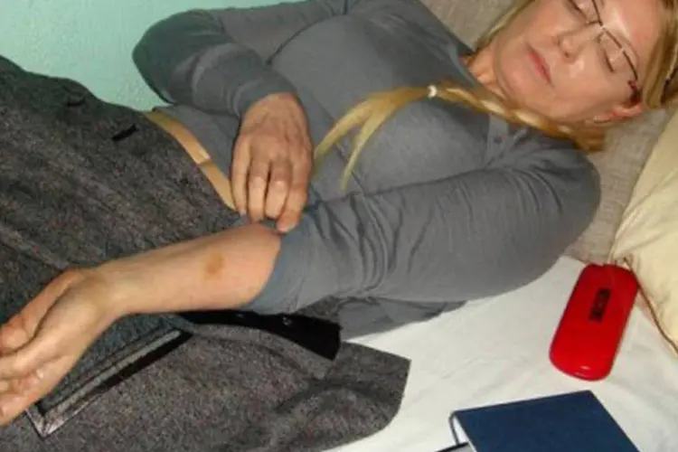 Yulia Tymoshenko mostra um machucado no braço, na penitenciária de Kharkiv: Timoshenko foi condenada a sete anos de prisão por abuso de poder (©AFP / -)