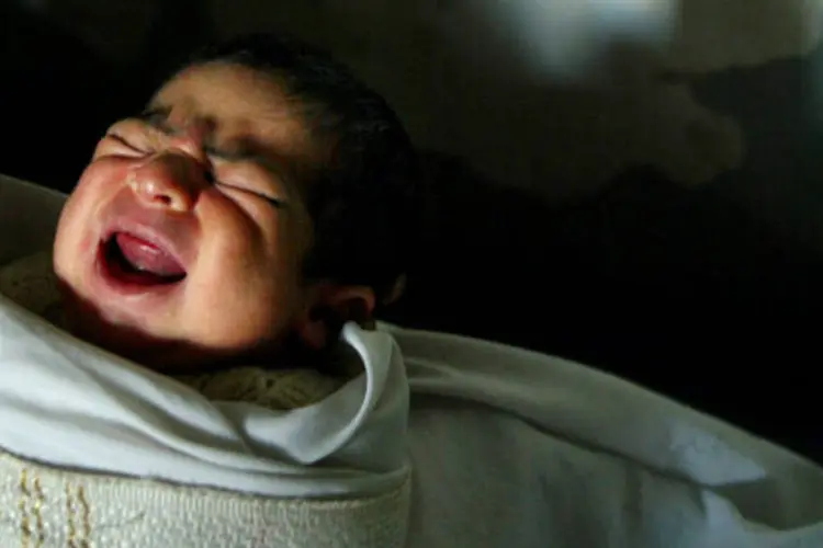 Bebês: essas alterações, em geral, são imperceptíveis a olho nu (Paula Bronstein/Getty Images/Getty Images)