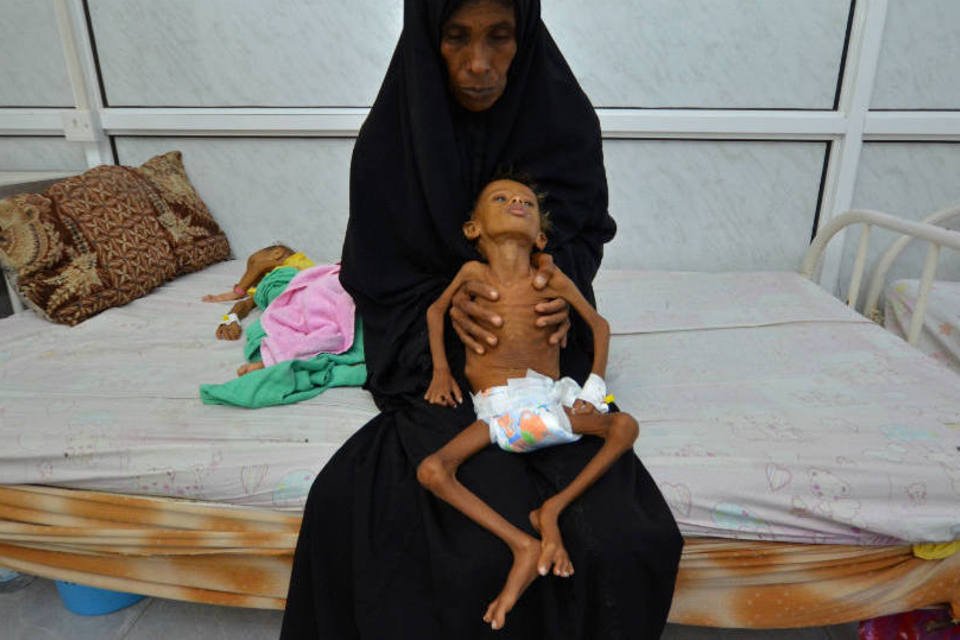 Unicef: a cada 10 minutos, uma criança morre no Iêmen