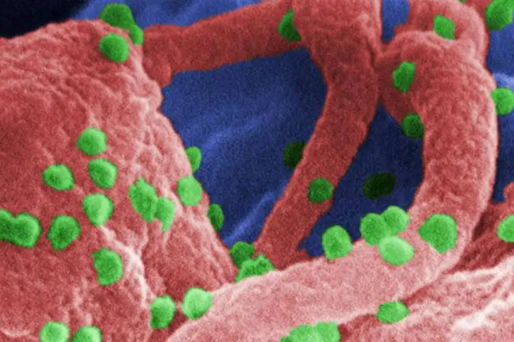 HIV: "O próprio vírus faz com que haja aumento de colesterol e triglicerídeos e destrói vasos" (CDC USA/Reprodução)