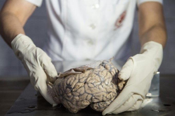 Cérebro humano: cientistas também examinaram outras zonas do cérebro envolvidas no reconhecimento dos lugares