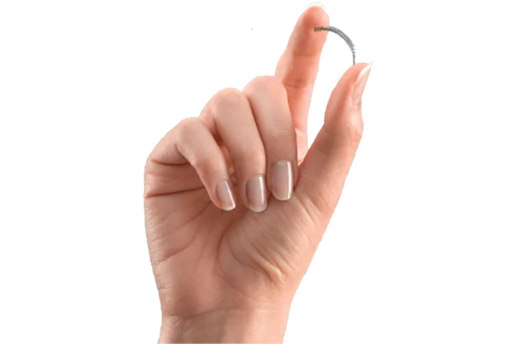  (Divulgação Essure.com/Divulgação)