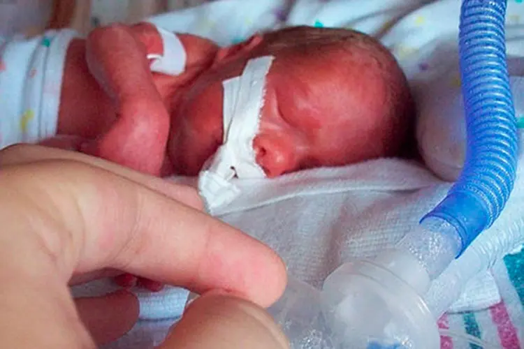 Imagem ilustrativa de bebê prematuro. (CC BY 2.0/ CC/Wikimedia Commons)