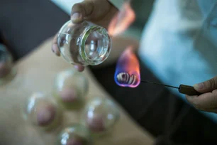 Imagem referente à matéria: China acelera a integração entre inteligência artificial e medicina tradicional chinesa