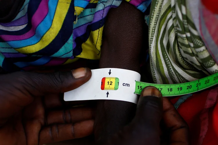 Desnutrição: a maioria dos países africanos mostra uma melhoria na desnutrição ao longo dos 15 anos pesquisados (Siegfried Modola/Reuters)