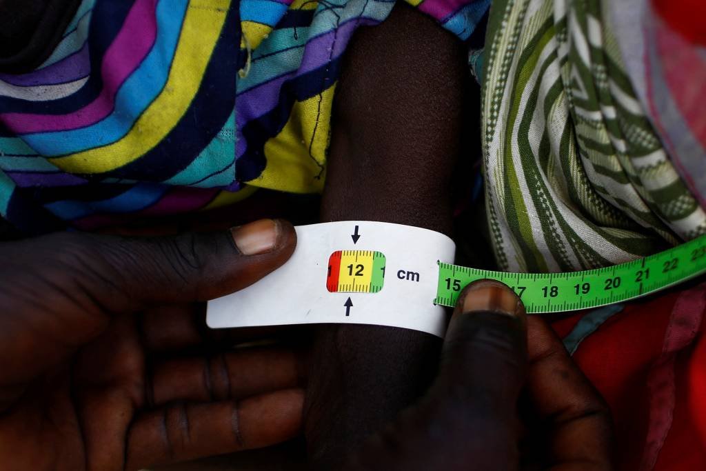 Nenhum país africano deve erradicar desnutrição até 2030