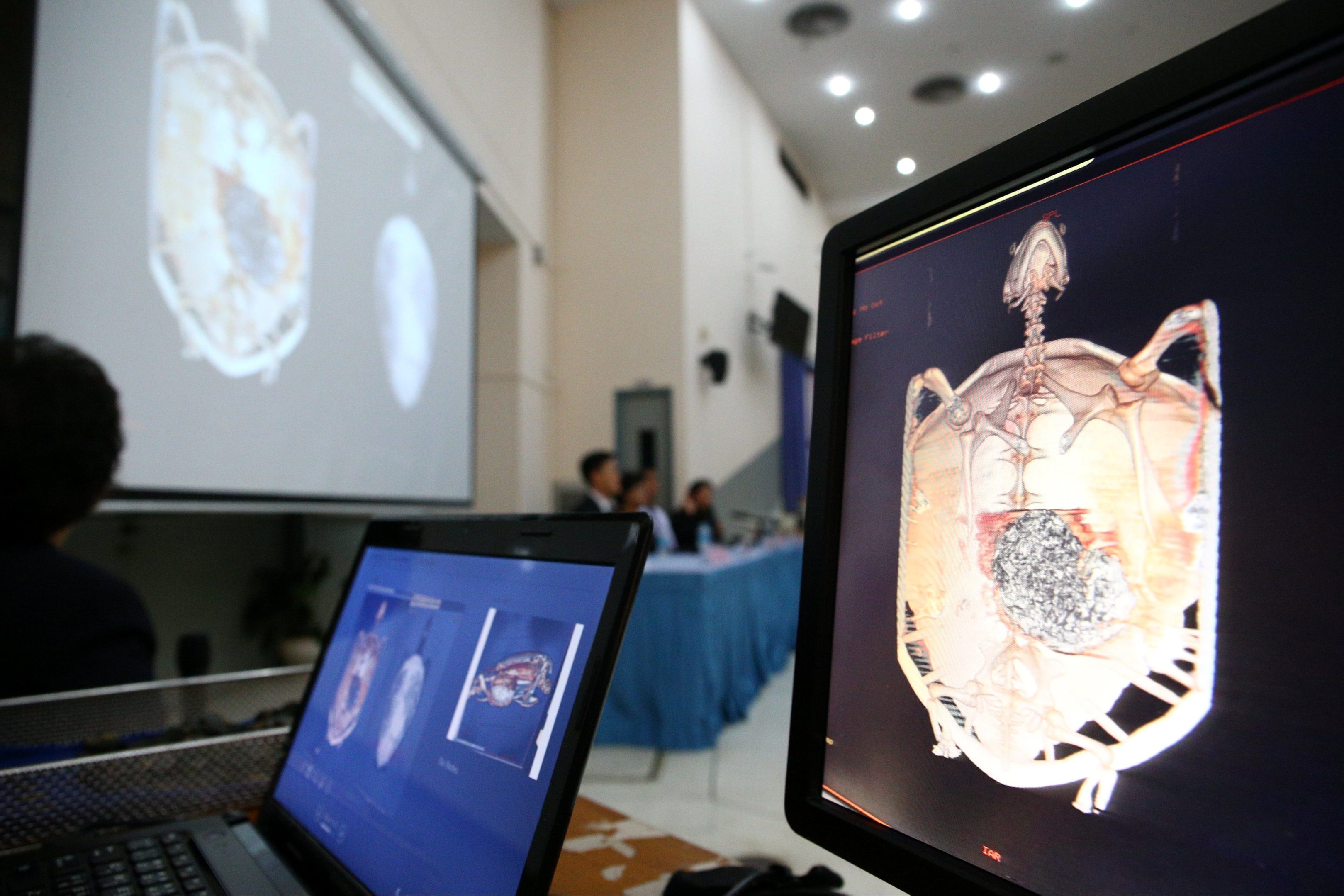 Veterinários retiram 915 moedas do estômago de tartaruga