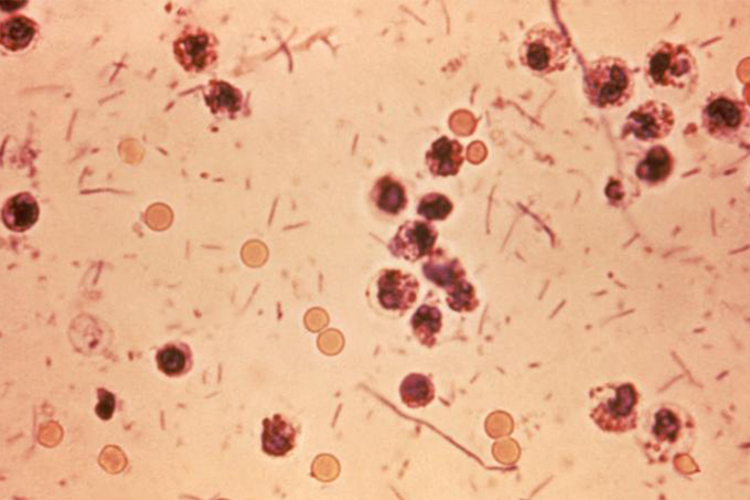 As 12 bactérias mais letais do mundo, segundo a OMS