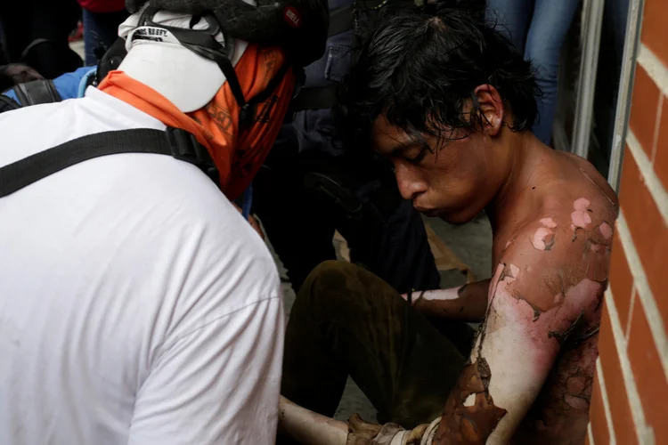 Manifestante com queimaduras: apoiados por carros blindados, militares e policiais utilizaram bombas de gás lacrimogêneo e jatos d'água para dispersar os manifestantes (Marco Bello/Reuters)