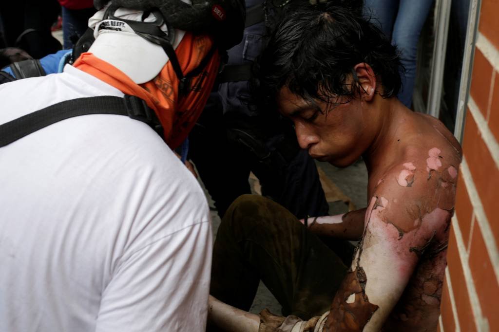 Manifestante é queimado durante protestos na Venezuela