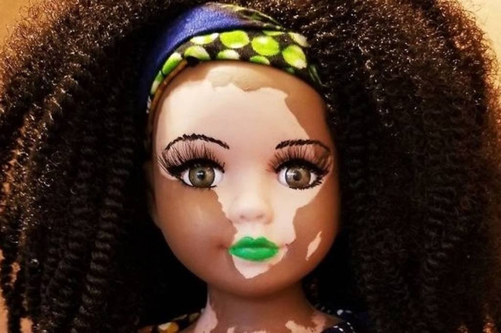 Bonecas com vitiligo geram furor nas redes sociais