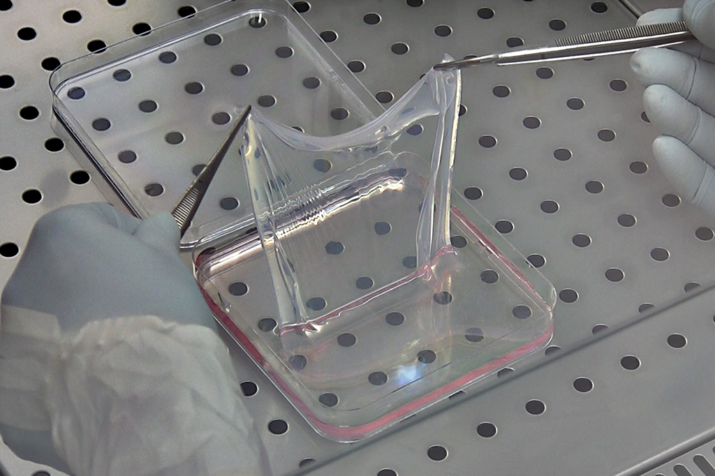 Pele feita com células tronco salva garoto com doença genética