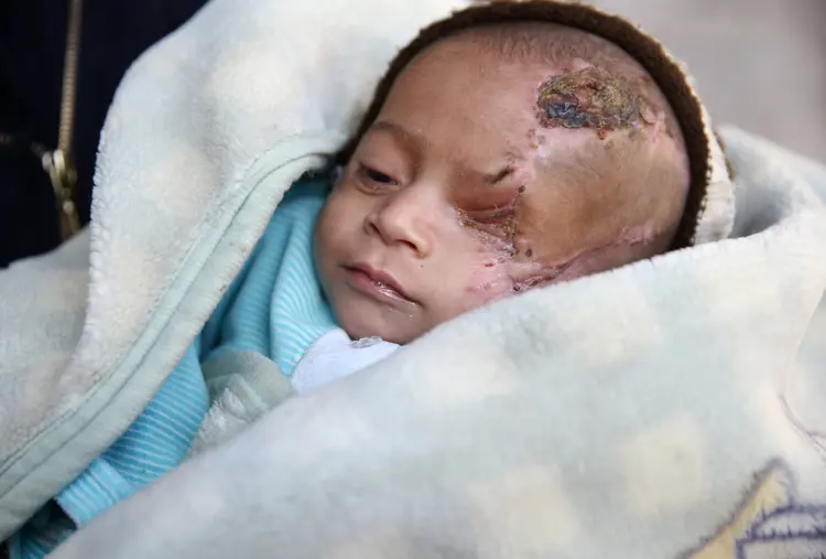Bebê sírio: a campanha chegou ao Conselho de Segurança da ONU (Reuters)