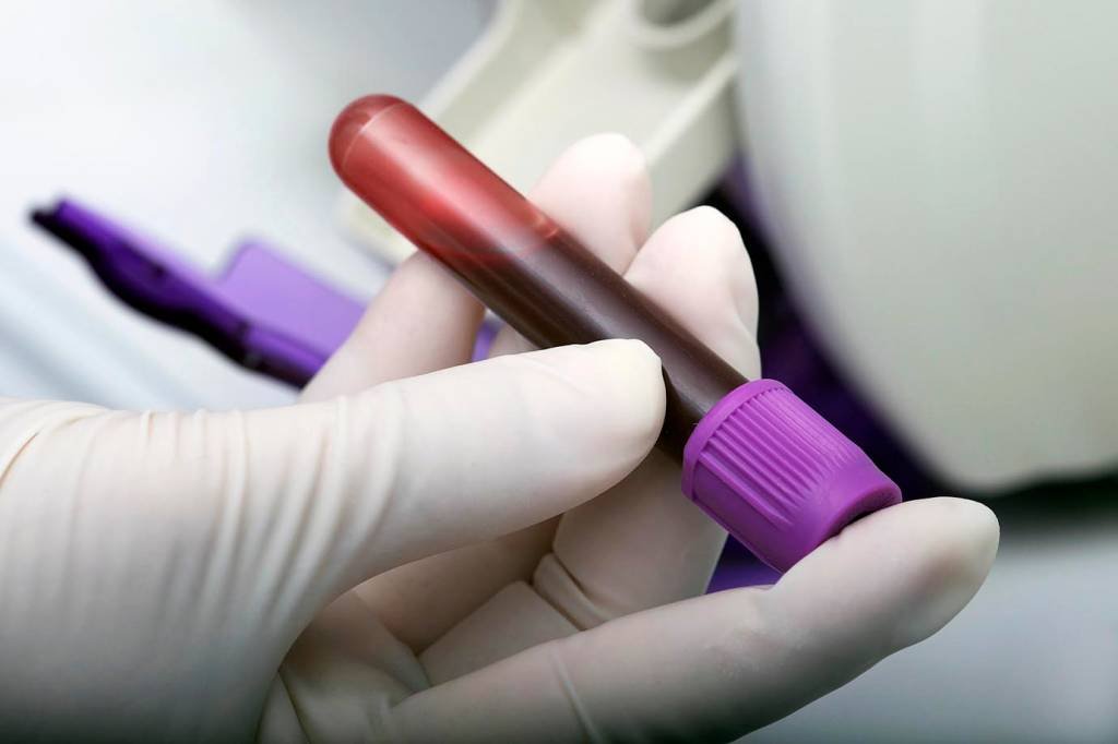 Exame de sangue brasileiro revela risco de infarto