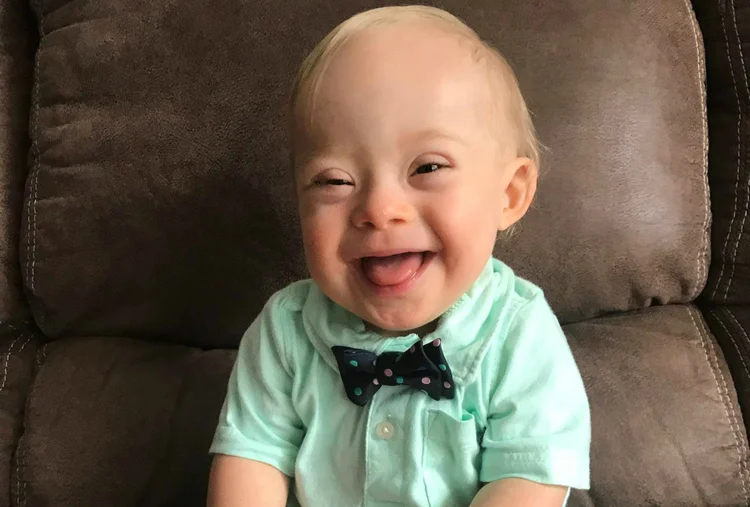 Lucas Warren: primeiro bebê com Síndrome de Down a estrelar campanha da Gerber (Gerber/Divulgação)