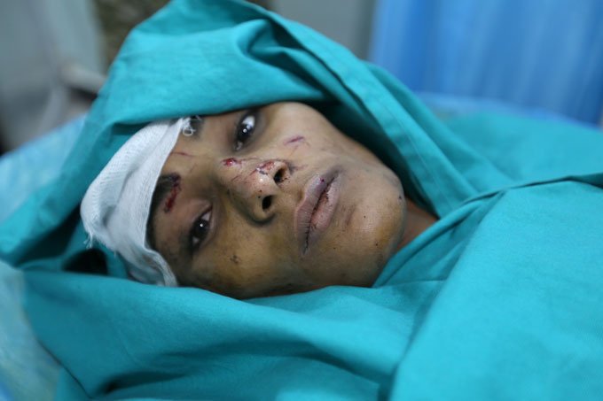 Ataque aéreo de coalizão mata 12 civis, incluindo 7 crianças, no Iêmen