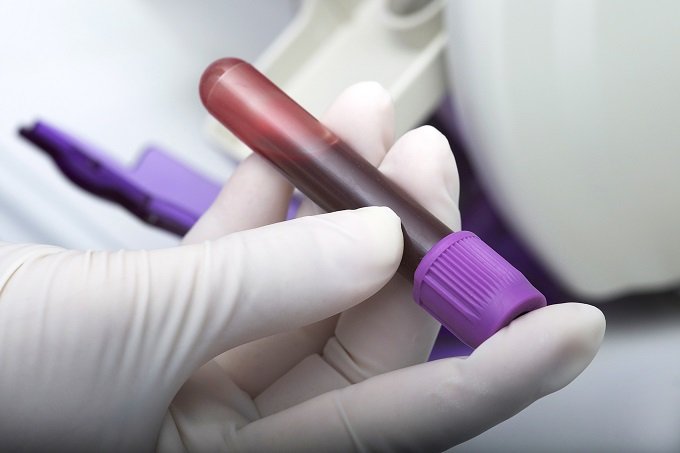 Este exame de sangue detecta a verdadeira idade do seu corpo