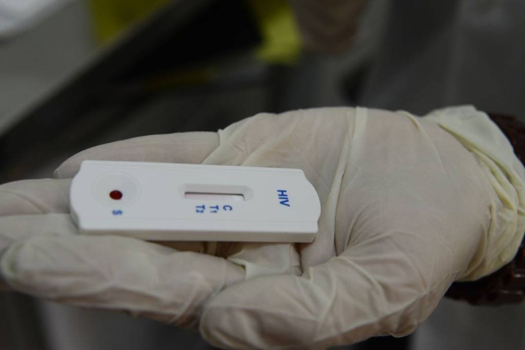 Diagnóstico: um teste gratuito pode ser feito para descobrir se o paciente tem hepatite c (Rovena Rosa/Agência Brasil)