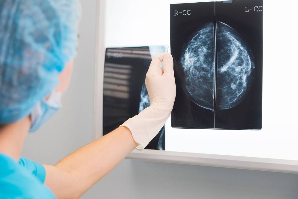 Conheça quatro pesquisas inovadoras para o combate ao câncer