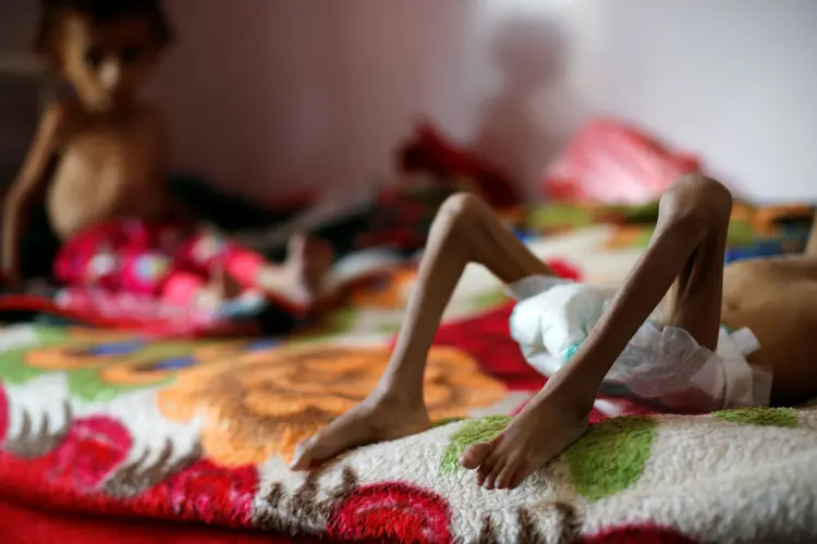 Crianças passam fome no Iêmen. (Khaled Abdullah/Reuters)
