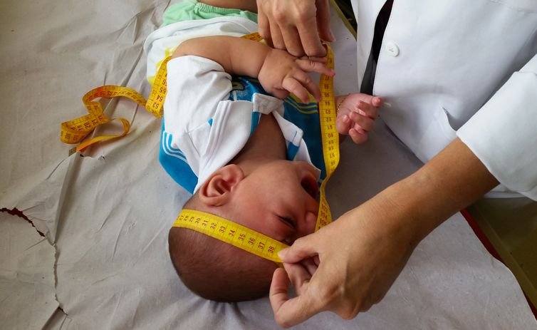 Microcefalia: mães ainda enfrentam uma rotina desgastante e solitária para cuidar dos filhos e buscar soluções para a doença (Agência Brasil/Sumaia Villela)