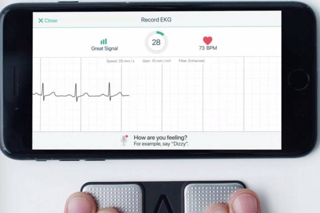 Aplicativo pode identificar infarto com a precisão de eletrocardiograma