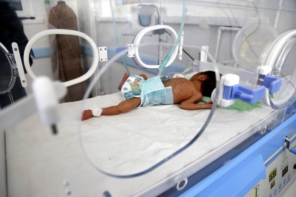 Mais de 400 mil crianças sofrem de desnutrição severa no Iêmen, diz Unicef
