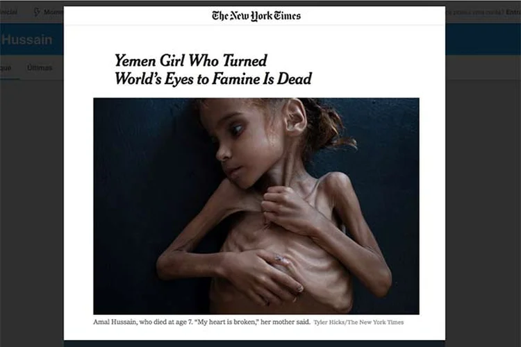 Menina iemenita que foi fotografada pelo The New York Times e que se tornou o rosto da fome provocada pela guerra. (The New York Times/ Twitter/Reprodução)