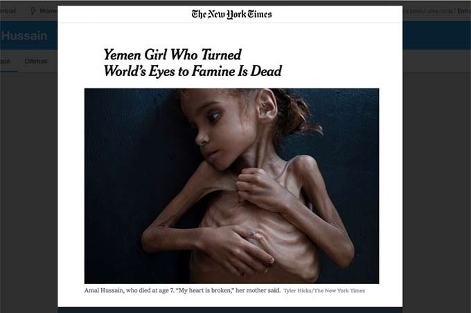 Morre menina de 7 anos que se tornou símbolo da fome no Iêmen