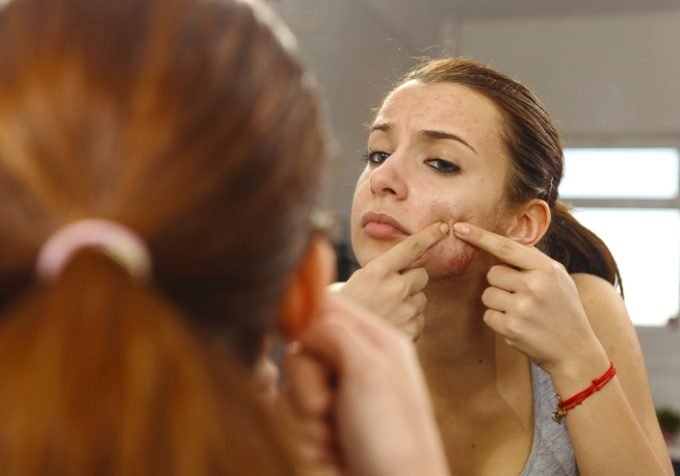 Cientistas analisam 27 mil pessoas para tirar as espinhas do seu rosto