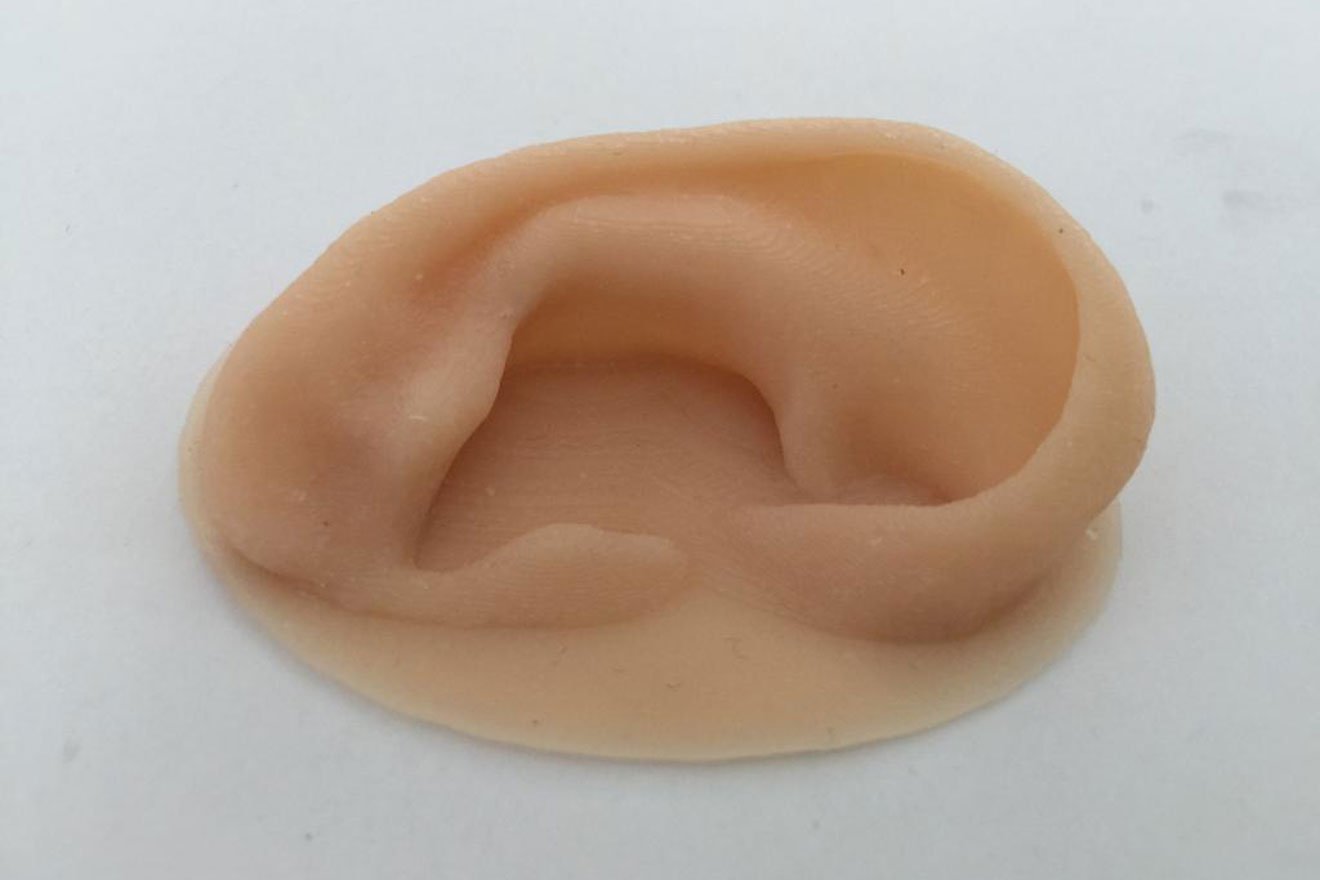 Startup brasileira cria próteses faciais feitas em impressora 3D