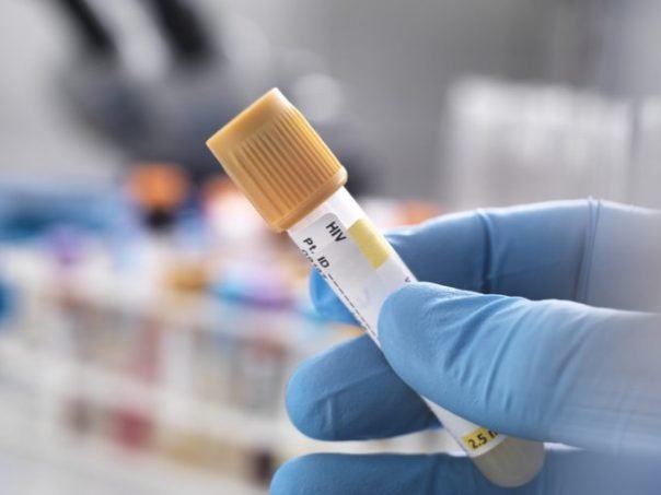 Cientistas brasileiros descobrem superterapia para cura da AIDS