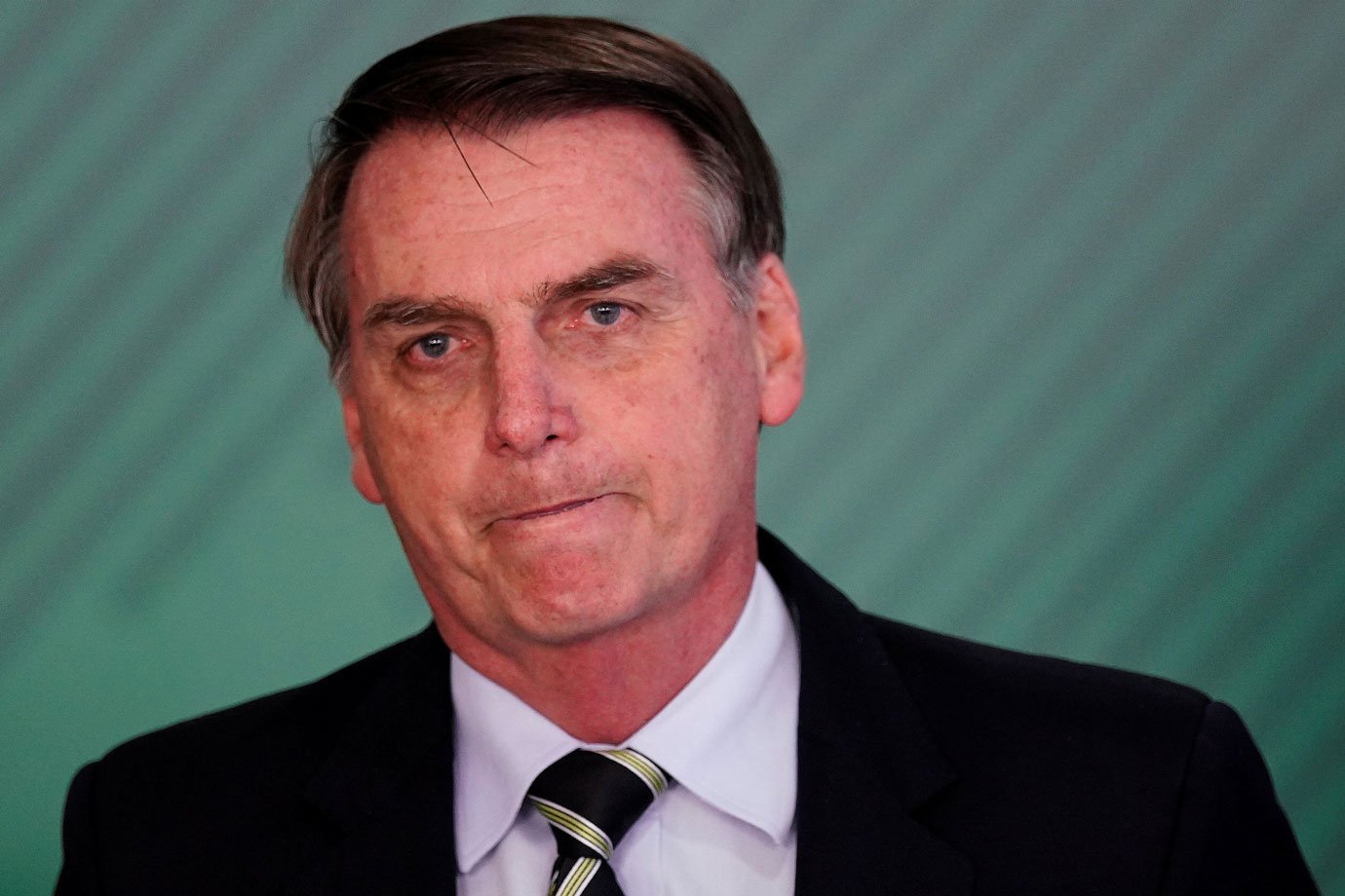 Após Cirurgia, Bolsonaro Vai Trabalhar No Hospital | Exame