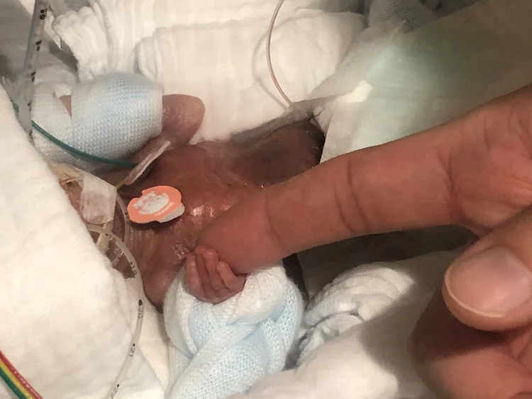 Um bebê prematuro que pesava 268 gramas no momento do parto deixou o hospital com boa saúde e pesando mais de três quilos (Keio University School of Medicine/Reuters)