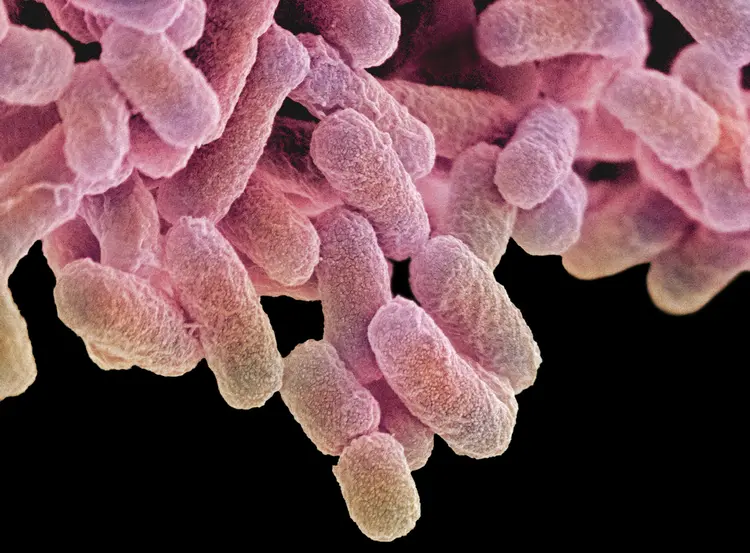 Mais de 2,6 mil sorotipos de Salmonella já são conhecidos (Science Photo Library - STEVE GSCHMEISSNER./Getty Images)