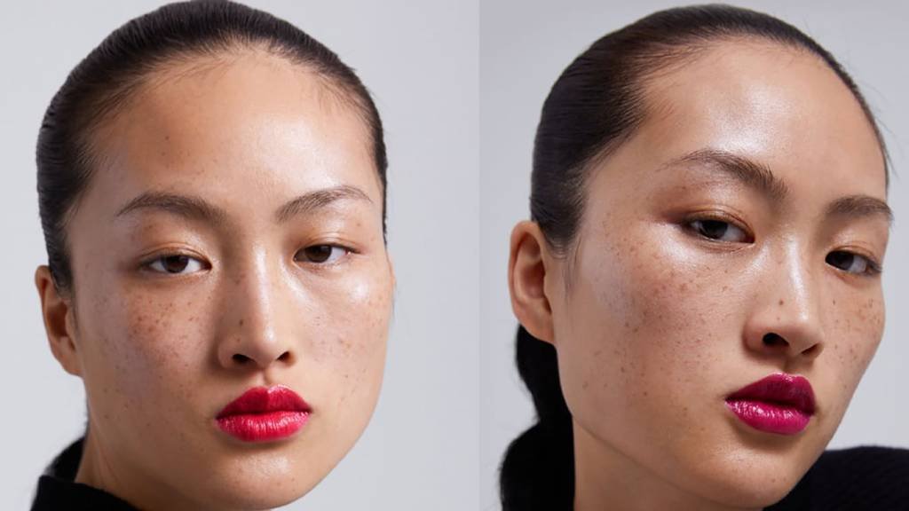 Zara coloca modelo com sardas em campanha - e os chineses não gostam