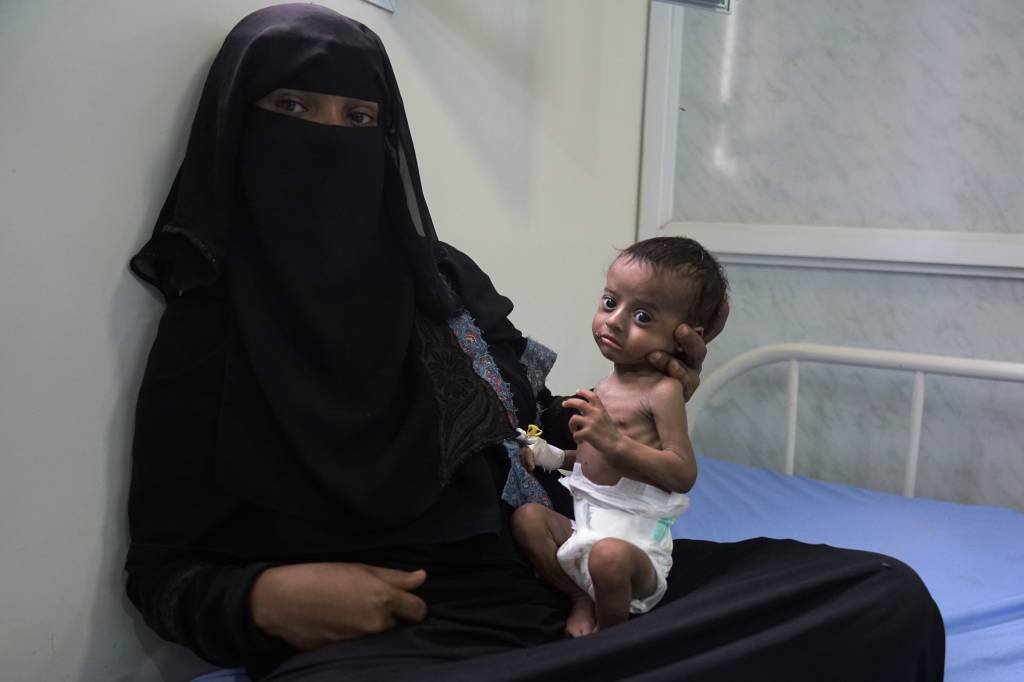 Iêmen: conflitos armados motivaram a desnutrição de 74 milhões de pessoas em 21 países (Giles Clarke/Getty Images)