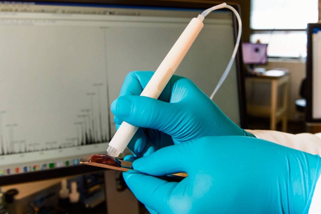 Cientista brasileira cria "caneta" que detecta câncer durante cirurgia