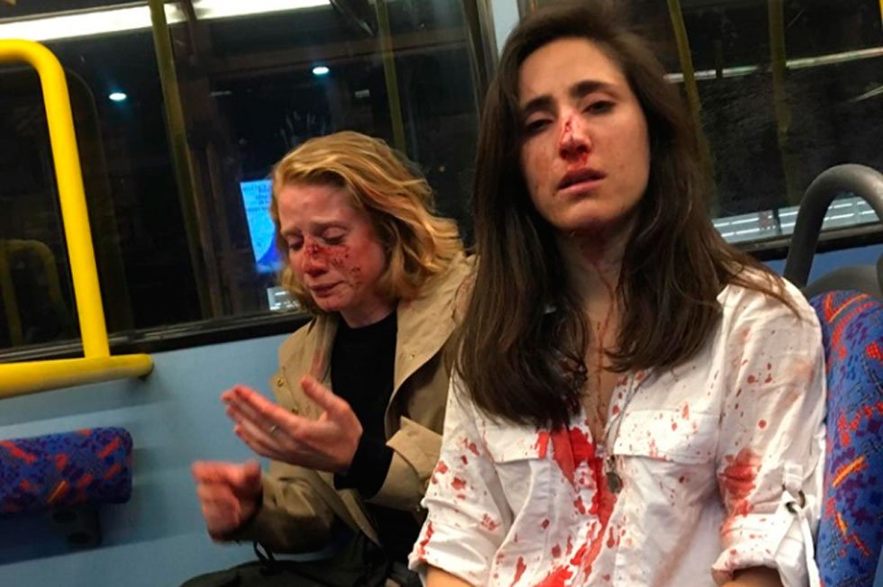 Casal de lésbicas é atacado por grupo de homens em ônibus de Londres