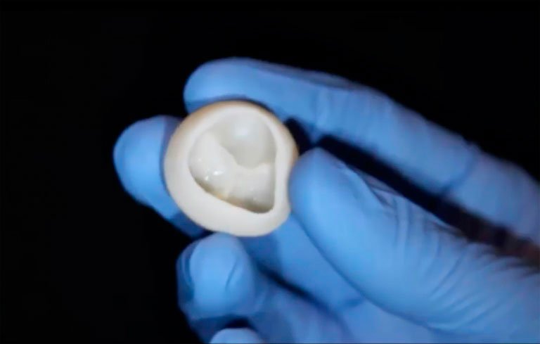 Impressão 3D: Cientistas conseguem criar partes de coração (Agence France-Presse/AFP)