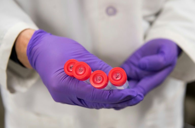 Pesquisa científica: a pesquisa consiste em implantar, em embriões animais modificados, células-tronco humanas chamadas "iPS" (AFP/Getty Images)