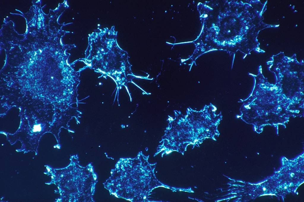 Câncer: nova forma de diagnosticar câncer de próstata é descoberta por cientistas do Reino Unido (Pixabay/Reprodução)