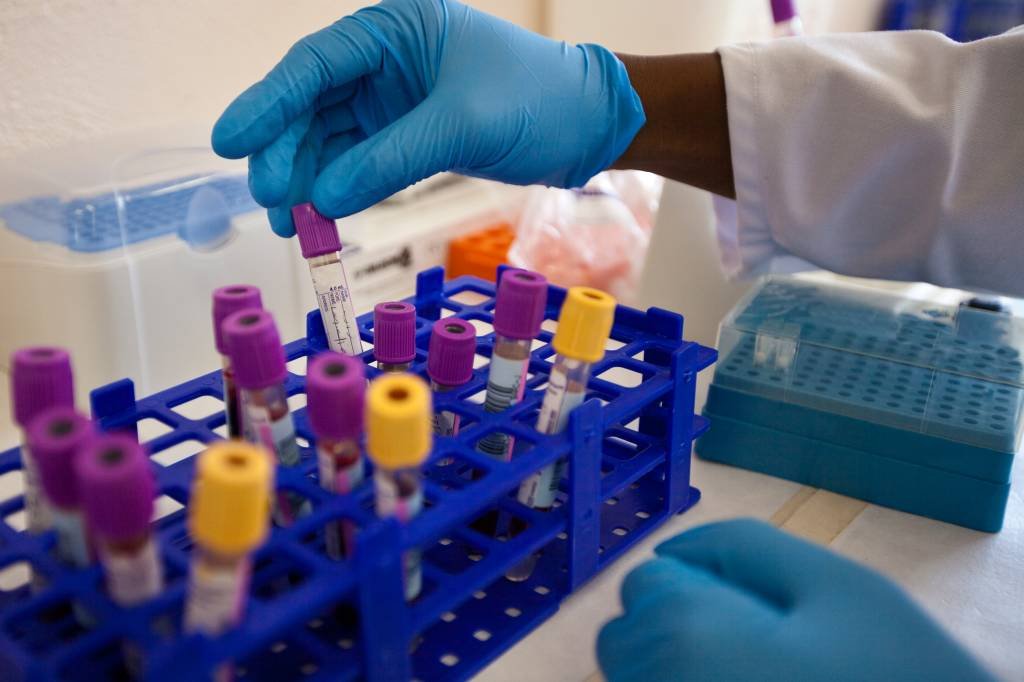 Novo vírus HIV é descoberto pela 1ª vez em vinte anos