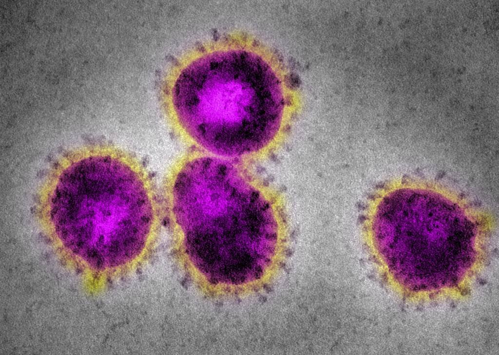 Em simulação, coronavírus matou 65 milhões de pessoas