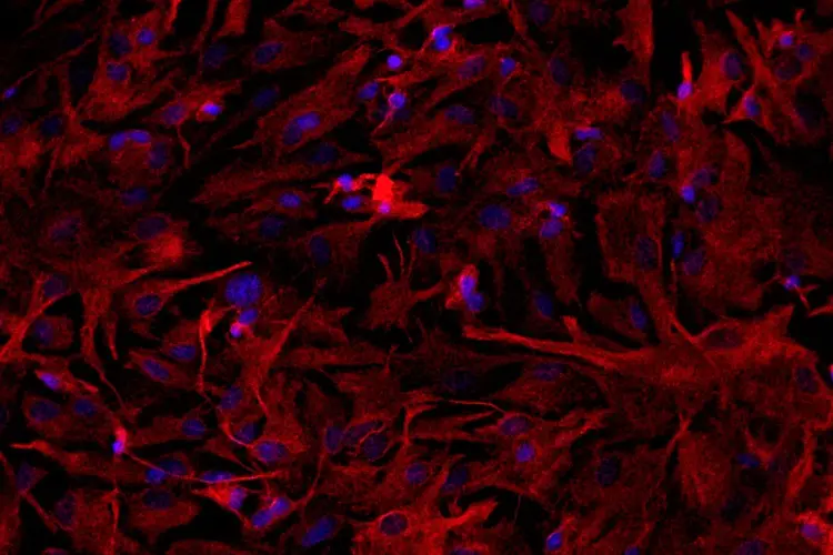 Células cerebrais: testes com ratos indicam que células cerebrais submetidas a baixa oxigenação desenvolvem disfunção no mecanismo de produção de energia (Luiz Felipe Souza e Silva/Agência Fapesp)