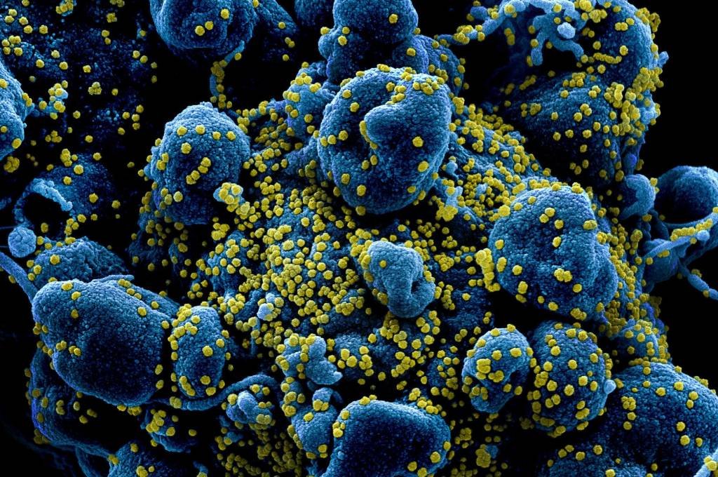 Imagens mostram coronavírus atacando células humanas
