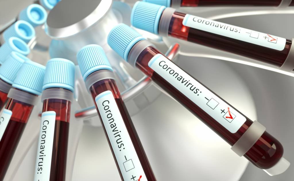 Teste para coronavírus será coberto por planos de saúde, diz ministério