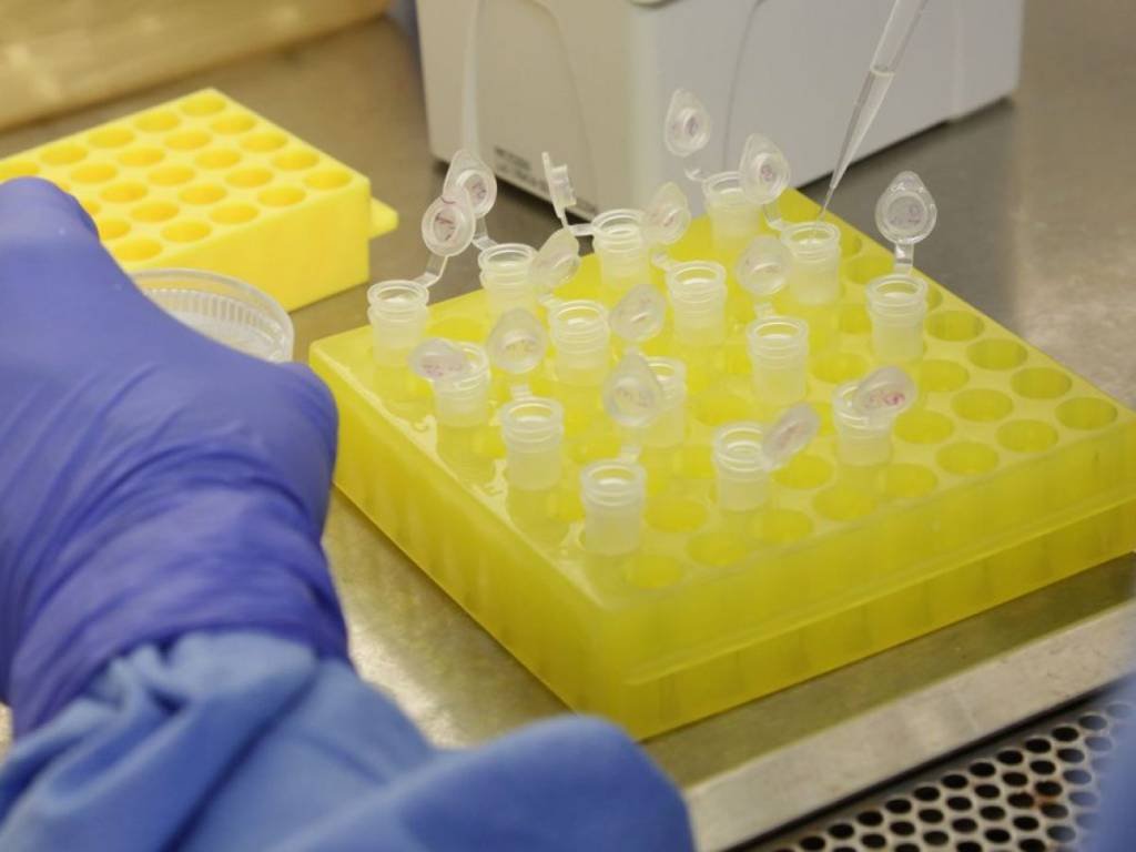 Ministério da Ciência irá investir R$ 100 mi no combate ao coronavírus