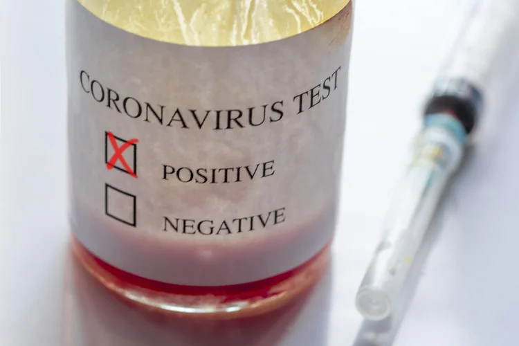 Coronavírus: detecção precoce da doença pode favorecer seu controle (Getty Images/Reprodução)